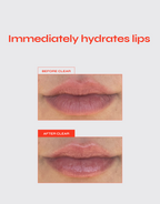 Lip Jelly